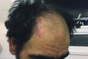 Moradores  relatam abuso de autoridade