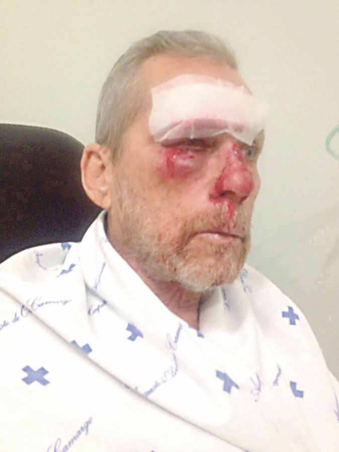 hematomas Idoso chegou a ser socorrido e encaminhado ao Haoc