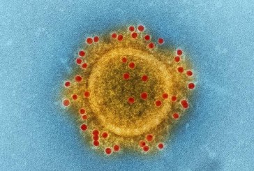 Mais casos de varíola em Indaiatuba